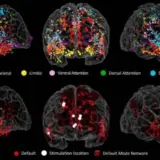 Витоки креативності у мозку виявили вчені