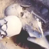 В Греции найден воин с восстановленной челюстью по методу Гиппократа