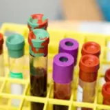 Нове відкриття у системі груп крові