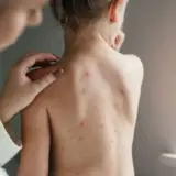 Кір – один із ключових факторів