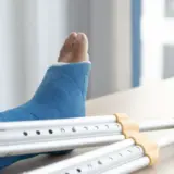 Як звичайна підтримка повертає рух