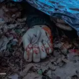 Обстрел Винницкой области – количество пострадавших возросло до 18