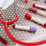 Названо 4 неочевидні причини високого холестерину