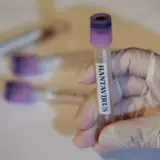 У ЦОЗ назвали кількість випадків зараження хантавірусом в Україні за 2025 та 2026 роки