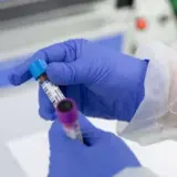 По оценкам ВОЗ к 2050 году число новых случаев рака в мире увеличится до 35 млн